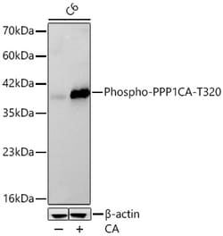 Invitrogen Phospho-PP1 alpha (Thr320) Recombinant Rabbit Monoclonal Antibody
