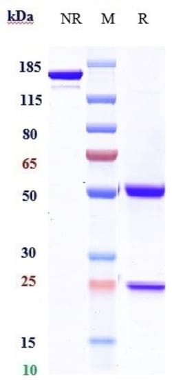 Invitrogen Ipilimumab Recombinant Monoclonal Antibody 1 mg; Unconjugated:Antibodies,