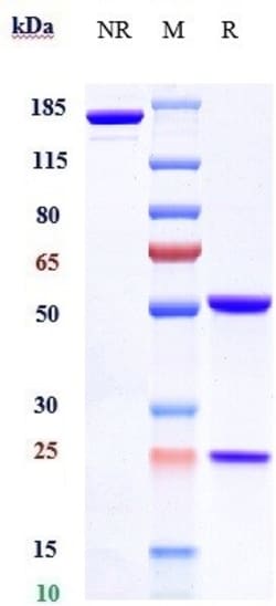 Invitrogen Farletuzumab Recombinant Monoclonal Antibody 1 mg; Unconjugated:Antikörper