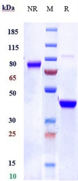 Invitrogen Vobarilizumab Recombinant Monoclonal Antibody 100 &mu;g; Unconjugated:Antibodies,