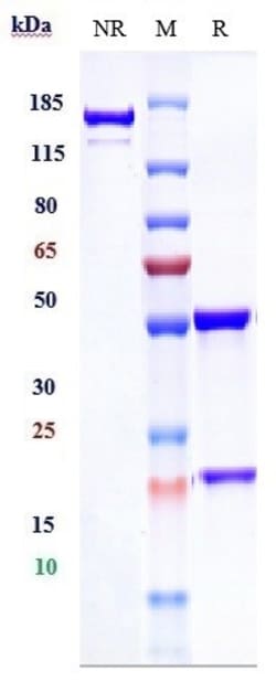 Invitrogen Infliximab Recombinant Monoclonal Antibody 1 mg; Unconjugated:Antibodies,