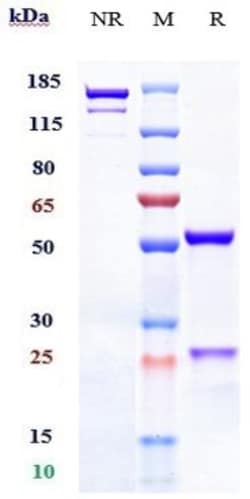 Invitrogen Belimumab Recombinant Monoclonal Antibody:Antibodies:Primary