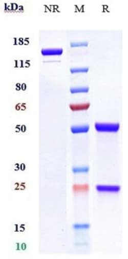 Invitrogen Girentuximab Recombinant Monoclonal Antibody 1 mg; Unconjugated:Antibodies,