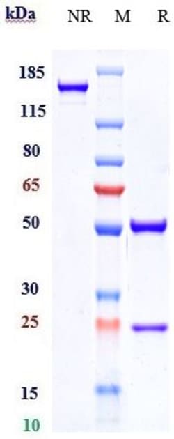 Invitrogen Eldelumab Recombinant Monoclonal Antibody 100 &mu;g; Unconjugated:Antibodies,