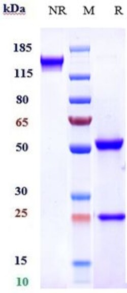 Invitrogen Sibrotuzumab Recombinant Monoclonal Antibody 100 &mu;g; Unconjugated:Antikörper