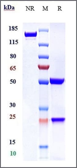 Invitrogen Ferroportin Biosimilar Recombinant Monoclonal Antibody:Antibodies:Primary