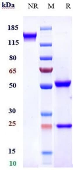 Invitrogen FGFR4 Biosimilar Recombinant Monoclonal Antibody 100 &mu;g:Antibodies,