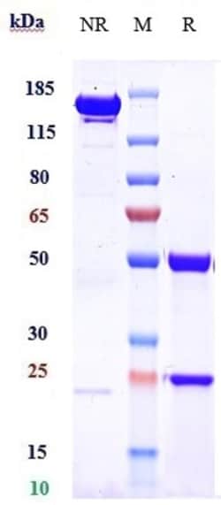 Invitrogen Teprotumumab Recombinant Monoclonal Antibody 100 &mu;g, Unconjugated:Antibodies,