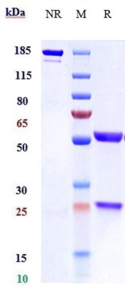 Invitrogen Pascolizumab Recombinant Monoclonal Antibody 100 &mu;g; Unconjugated:Antibodies,
