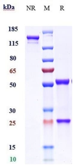 Invitrogen Enokizumab Recombinant Monoclonal Antibody 1 mg; Unconjugated:Antibodies,