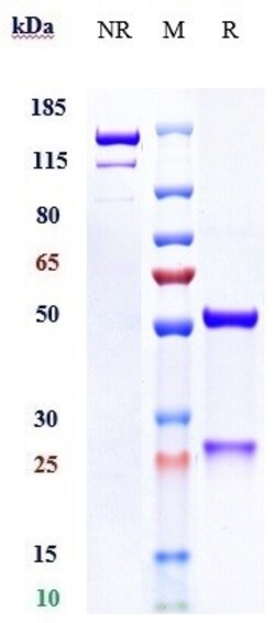 Invitrogen Anetumab Recombinant Monoclonal Antibody 1 mg; Unconjugated:Antibodies,
