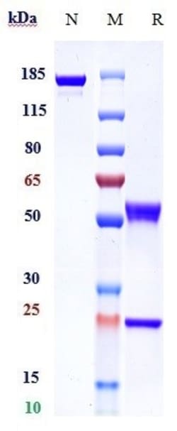 Invitrogen Andecaliximab Recombinant Monoclonal Antibody:Antibodies:Primary