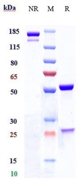 Invitrogen Brontictuzumab Recombinant Monoclonal Antibody 1 mg; Unconjugated:Antibodies,