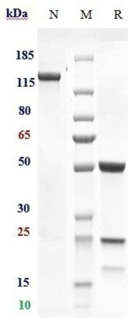 Invitrogen Murlentamab Recombinant Monoclonal Antibody 1 mg; Unconjugated:Antibodies,