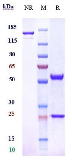 Invitrogen Enibarcimab Recombinant Monoclonal Antibody 100 &mu;g, Unconjugated:Antibodies,