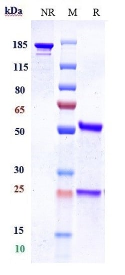 Invitrogen Properdin Biosimilar Recombinant Monoclonal Antibody 100 &mu;g:Antibodies,