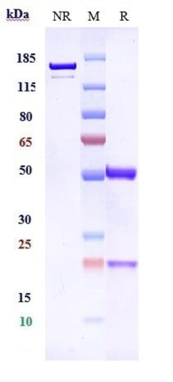 Invitrogen 5T4 Biosimilar Recombinant Monoclonal Antibody 1 mg; Unconjugated:Antibodies,