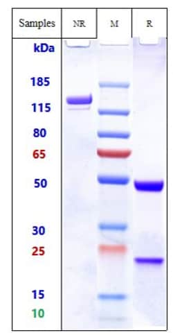 Invitrogen Bivatuzumab Recombinant Monoclonal Antibody 1 mg; Unconjugated:Antibodies,