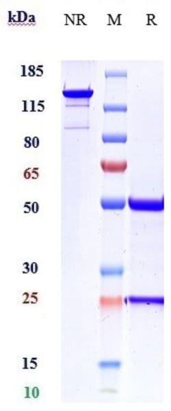 Invitrogen ACVR2B Biosimilar Recombinant Monoclonal Antibody 1 mg; Unconjugated:Antibodies,