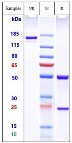 Invitrogen Actoxumab Recombinant Monoclonal Antibody 1 mg; Unconjugated:Antibodies,