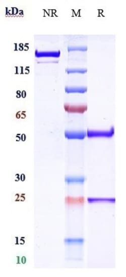 Invitrogen Ublituximab Recombinant Monoclonal Antibody 1 mg; Unconjugated:Antibodies,