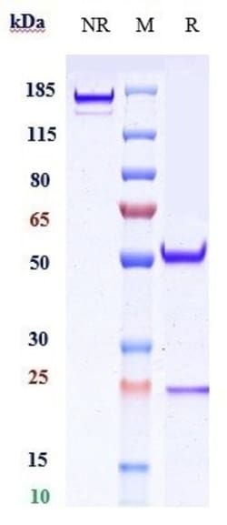 Invitrogen Veltuzumab Recombinant Monoclonal Antibody 100 &mu;g; Unconjugated:Antibodies,
