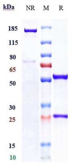 Invitrogen Ibalizumab Recombinant Monoclonal Antibody 1 mg; Unconjugated:Antibodies,