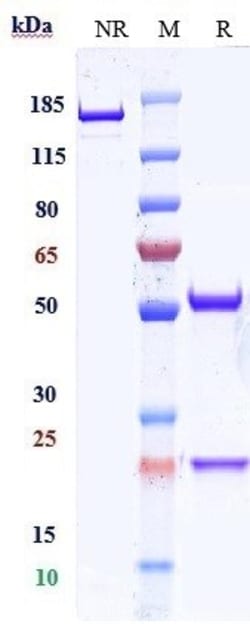 Invitrogen Urabrelimab Recombinant Monoclonal Antibody:Antibodies:Primary