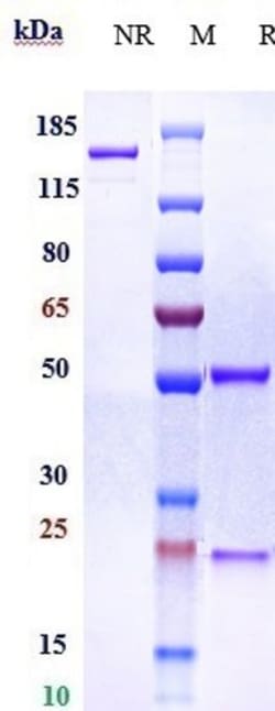 Invitrogen Lampalizumab Recombinant Monoclonal Antibody 100 &mu;g; Unconjugated:Antibodies,