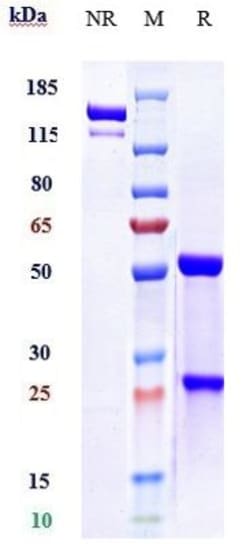 Invitrogen Evolocumab Recombinant Monoclonal Antibody 100 &mu;g; Unconjugated:Antikörper