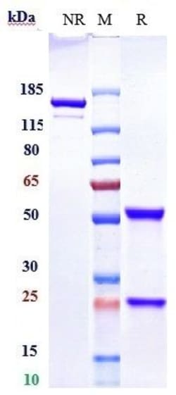 Invitrogen SGPP1 Biosimilar Recombinant Monoclonal Antibody 1 mg; Unconjugated:Antibodies,