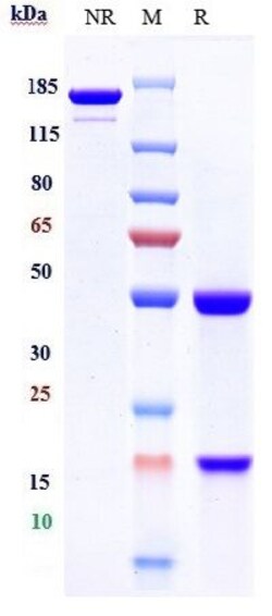 Invitrogen Perakizumab Recombinant Monoclonal Antibody:Antikörper:Primärantikörper