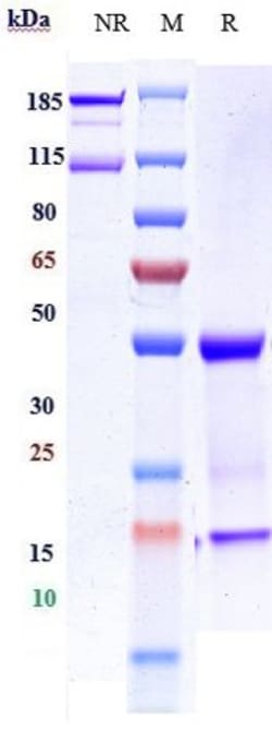 Invitrogen Imgatuzumab Recombinant Monoclonal Antibody 1 mg:Antibodies,