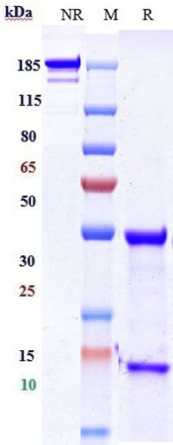 Invitrogen Matuzumab Recombinant Monoclonal Antibody 1 mg; Unconjugated:Antikörper