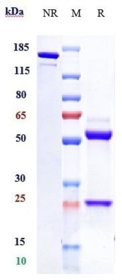 Invitrogen Ifabotuzumab Recombinant Monoclonal Antibody 1 mg; Unconjugated:Antibodies,