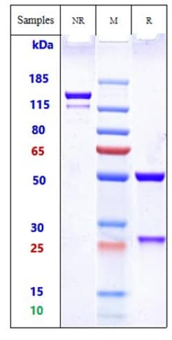 Invitrogen Hersintuzumab Recombinant Monoclonal Antibody 1 mg; Unconjugated:Antibodies,