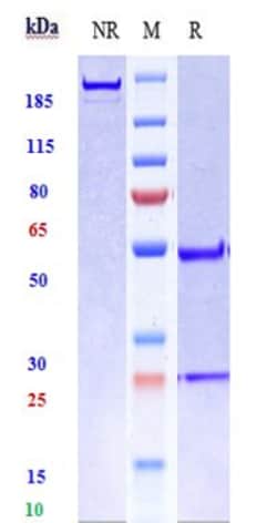 Invitrogen Radretumab Recombinant Monoclonal Antibody 100 &mu;g, Unconjugated:Antibodies,