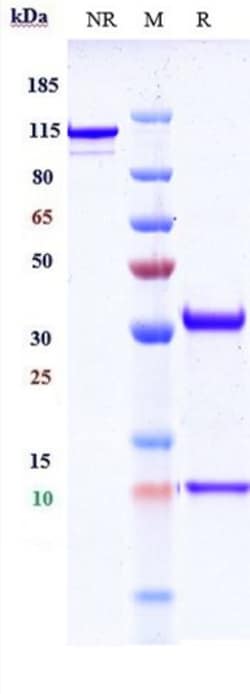 Invitrogen Lodelcizumab Recombinant Monoclonal Antibody 100 &mu;g; Unconjugated:Antibodies,