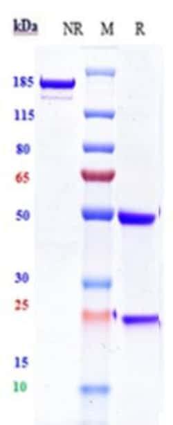 Invitrogen Loncastuximab Recombinant Monoclonal Antibody 1 mg; Unconjugated:Antibodies,