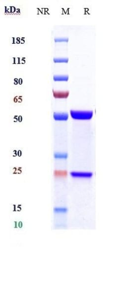 Invitrogen Avizakimab Recombinant Monoclonal Antibody 100 &mu;g, Unconjugated:Antibodies,