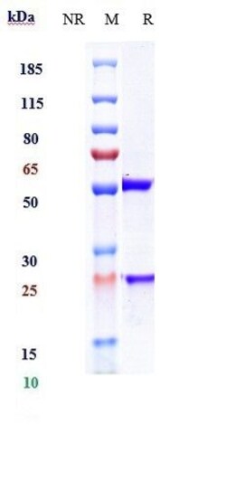 Invitrogen Ofatumumab Recombinant Monoclonal Antibody 1 mg; Unconjugated:Antibodies,