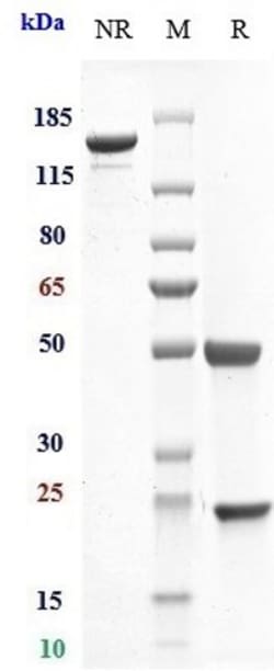 Invitrogen IL-6 Biosimilar Recombinant Monoclonal Antibody 1 mg; Unconjugated:Antibodies,