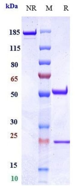 Invitrogen Oportuzumab Recombinant Monoclonal Antibody 100 &mu;g; Unconjugated:Antibodies,