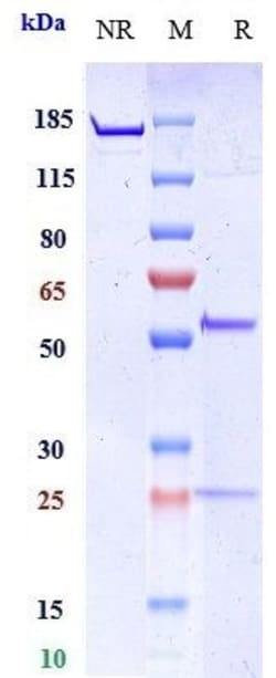 Invitrogen MMP-9 Biosimilar Recombinant Monoclonal Antibody 1 mg; Unconjugated:Antibodies,