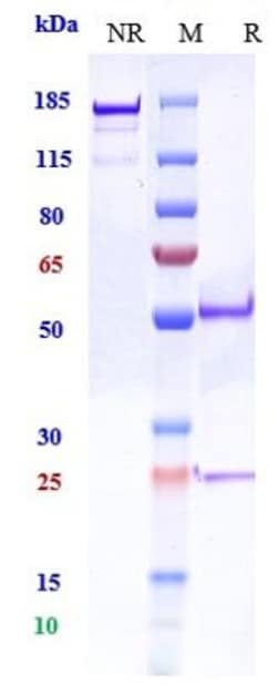 Invitrogen PCSK9 Biosimilar Recombinant Monoclonal Antibody 1 mg; Unconjugated:Antibodies,