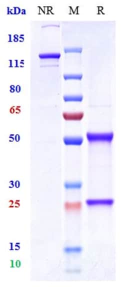 Invitrogen Vandortuzumab Recombinant Monoclonal Antibody 100 &mu;g; Unconjugated:Antibodies,