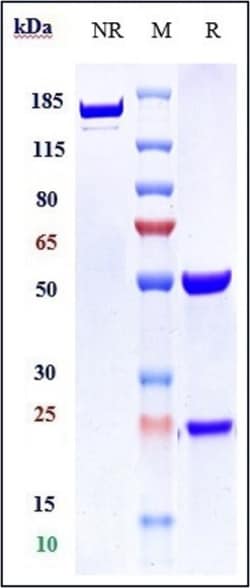 Invitrogen Bapineuzumab Recombinant Monoclonal Antibody:Antibodies:Primary