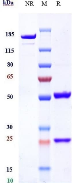 Invitrogen Pabinafusp Alfa Recombinant Monoclonal Antibody 1 mg; Unconjugated:Antibodies,