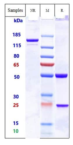 Invitrogen ADAM9 Biosimilar Recombinant Monoclonal Antibody 1 mg; Unconjugated:Antibodies,
