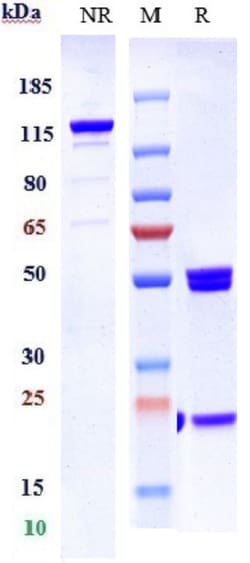 Invitrogen Vanucizumab Recombinant Human Monoclonal Antibody 1 mg; Unconjugated:Antibodies,